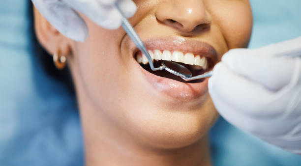 Best Walk-In Emergency Dentist in Stapleton, AL