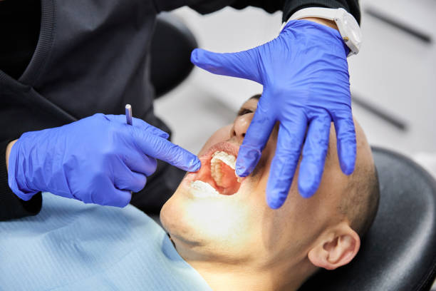 Best Emergency Broken Tooth Repair in Stapleton, AL